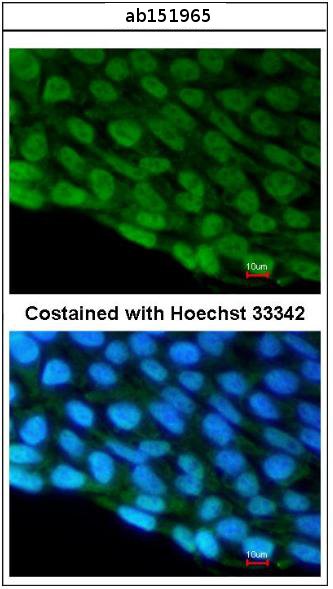 Immunofluorescence analysis of paraformaldehyde-fixed Human embryonic stem cells, labeling DDX3 with ab151965 at a 1/200 dilution.