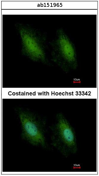Immunofluorescence analysis of paraformaldehyde-fixed HeLa cells, labeling DDX3 with ab151965 a 1/500 dilution.