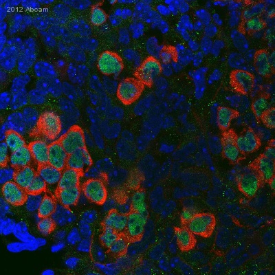 IHC-Fr image of DDX4 (ab27591) on mouse embryonic gonad cells. The sections were fixed with 4% PFA, permeabilized and blocked in BSA, before incubation with the DDX4 antibody (1/100 dilution) for 12 hours at 4 degrees. Cytoplasmic staining of the mouse primordial germ cells by ab27591 is shown in red and Oct4-GFP staining is shown in green.See Abreview