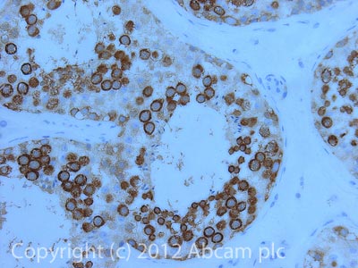 IHC image of DDX4/MVH staining in Human normal Testis formalin fixed paraffin embedded tissue section, performed on a Leica BondTM system using the standard protocol F. The section was pre-treated using heat mediated antigen retrieval with sodium citrate buffer (pH6, epitope retrieval solution 1) for 20 mins. The section was then incubated with ab27591, 0.1µg/ml, for 15 mins at room temperature and detected using an HRP conjugated compact polymer system. DAB was used as the chromogen. The section was then counterstained with haematoxylin and mounted with DPX.For other IHC staining systems (automated and non-automated) customers should optimize variable parameters such as antigen retrieval conditions, primary antibody concentration and antibody incubation times.