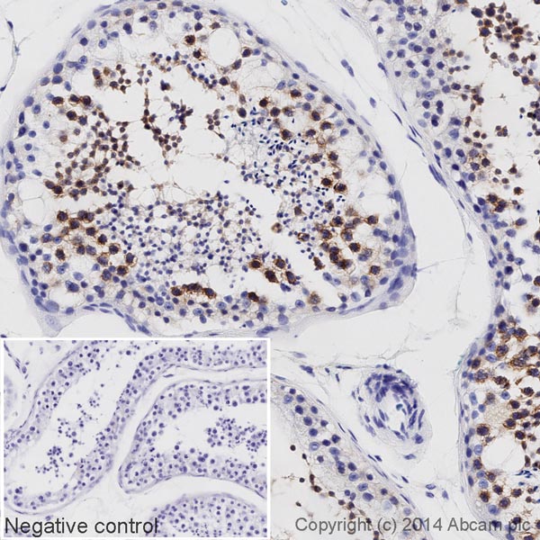 IHC image of DDX4 / MVH staining in a section of formalin-fixed paraffin-embedded normal human testis*, performed on a Leica BOND. The section was pre-treated using heat mediated antigen retrieval with sodium citrate buffer (pH6, epitope retrieval solution 1) for 20mins. The section was then incubated with ab196709 at 1/500 dilution, for 15 mins at room temperature. DAB was used as the chromogen. The section was then counterstained with haematoxylin and mounted with DPX. The inset negative control image is taken from an identical assay without primary antibody.For other IHC staining systems (automated and non-automated) customers should optimize variable parameters such as antigen retrieval conditions, primary antibody concentration and antibody incubation times.*Tissue obtained from the Human Research Tissue Bank, supported by the NIHR Cambridge Biomedical Research Centre.