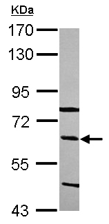 Anti-Complement factor 8 beta antibody (ab111700) at 1/5000 dilution + HepG2 whole cell lysate at 30 µg