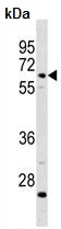 Anti-Complement factor 8 beta antibody - C-terminal (ab156106) at 1/100 dilution + CEM cell line lysate at 35 µg