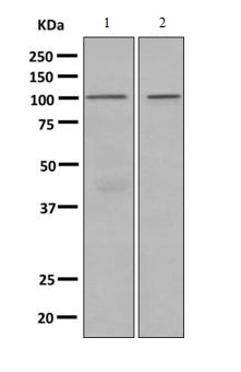 All lanes : Anti-Complement factor B antibody [EPR9287(B)] (ab140647) at 1/1000 dilutionLane 1 : Human serumLane 2 : Human plasmaLysates/proteins at 10 µg per lane.SecondaryHRP conjugated goat anti-rabbit at 1/2000 dilution