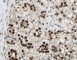 Image courtesy of Human Protein Atlasab21696 staining DDXA in paraffin embedded Human adrenal gland. The tissue was incubated with ab21696 (1/3000 dilution) for 30 mins at room temperature. Antigen retrieval was performed by heat induction in citrate buffer pH 6.Further results for this antibody can be found at www.proteinatlas.org