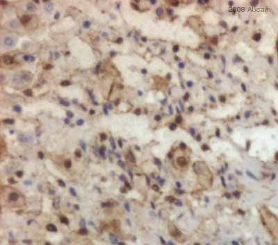 ab21696 staining mouse adrenal tissue sections by IHC-P.  Sections were formaldehyde fixed and subjected to heat mediated antigen retrieval in citrate buffer (pH 6) prior to blocking.  The primary antibody was diluted 1/1000 and incubated with the sample for 40 minutes at 20°C.  A HRP conjugated goat anti-rabbit antibody was used as the secondary.See Abreview