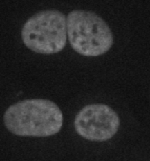 HT1080 cells were fixed with paraformaldehyde permeabilized with Triton (1%) and stained for 1 hr in a 1/100 dilution of the DDX5 antibody and thereafter for 1 hr with a rhodamine conjugated anti-goat secondary. This image was kindly supplied as part of the review submitted by Reinhard Kodym. 