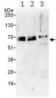 Immunoprecipitation of DDX56 (3 µg of antibody per mg of HeLa cell lysate; 20% of the IP loaded). Lane 1-Immunoprecipitation with an anti-DDX56 antibody that recognizes an upstream epitope; Lane 2- Immunoprecipitation with anti-DDX56 antibody (ab115158); Lane 3- Immunoprecipitation with IgG control. Anti-DDX56 antibody (ab115158) used at 1 µg/ml for western blot. Detection: Chemiluminescence with exposure time of 30 sec.