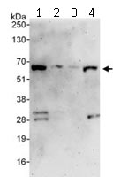 All lanes : Anti-DDX56 antibody (ab115158) at 0.1 µg/mlLane 1 : HeLa cell lysate at 50 µgLane 2 : HeLa cell lysate at 15 µgLane 3 : HeLa cell lysate at 5 µgLane 4 : 293T cell lysate at 50 µg