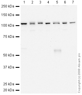 All lanes : Anti-DDX58 antibody (ab65588) at 1 µg/mlLane 1 : HeLa (Human epithelial carcinoma cell line) Whole Cell LysateLane 2 : Jurkat (Human T cell lymphoblast-like cell line) Whole Cell LysateLane 3 : A431 (Human epithelial carcinoma cell line) Whole Cell LysateLane 4 : HEK293 Human embryonic kidney cell line Whole Cell LysateLane 5 : HepG2 (Human hepatocellular liver carcinoma cell line) Whole Cell LysateLane 6 : MCF7 (Human breast adenocarcinoma cell line) Whole Cell LysateLane 7 : SHSY-5Y (Human neuroblastoma cell line) Whole Cell LysateLysates/proteins at 10 µg per lane.SecondaryGoat polyclonal to Rabbit IgG - H&L - Pre-Adsorbed (HRP) at 1/3000 dilutionPerformed under reducing conditions.