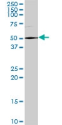 Anti-DDX59 antibody (ab69521) at 1/500 dilution + human liver tissue lysate at 25 µgSecondaryGoat anti-mouse IgG (H&L)-HRP conjugate at 1/2500 dilution