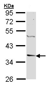 Anti-Decorin antibody (ab151988) at 1/1000 dilution + 293T whole cell lysate at 30 µg