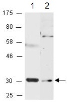 All lanes : Anti-Decorin antibody (ab157137) at 1/1000 dilutionLane 1 : Mouse brain total cell extractsLane 2 : MDA-MD231 total cell extracts