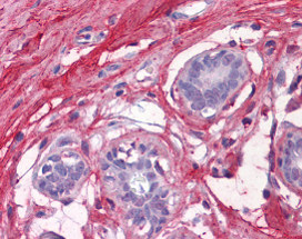 ab115744 at 5ug/ml staining Decorin in Human breast tissue by immunohistochemistry (FFPE).