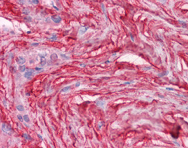 ab115744 at 5ug/ml staining Decorin in Human soft tissue by immunohistochemistry (FFPE).