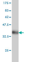 Western blot against tagged recombinant protein immunogen using ab56480 DEDD antibody at 1ug/ml.