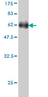 Western blot against tagged recombinant protein immunogen using ab57228 DEF6 antibody at 1ug/ml.