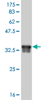 Western blot against tagged recombinant protein immunogen using ab56668 Deformed Epidermal Autoregulatory Factor 1 antibody at 1ug/ml.