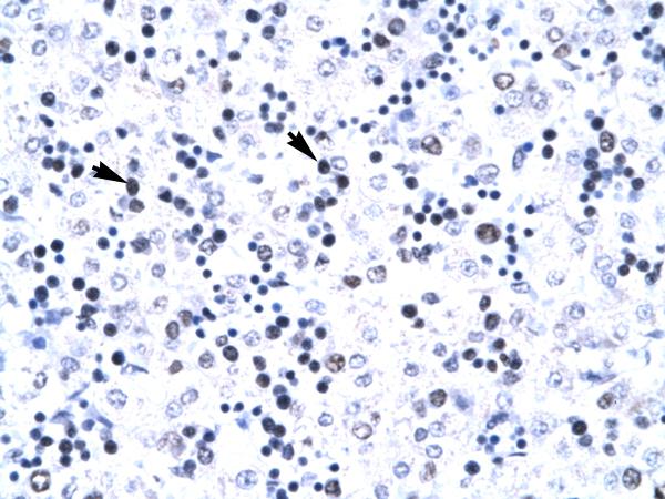 ab22826 at 4.0 - 8.0 ug/ml, staining human DEK in paraffin embedded liver tissue. Arrows indicate positively labelled cells (hepatocytes).