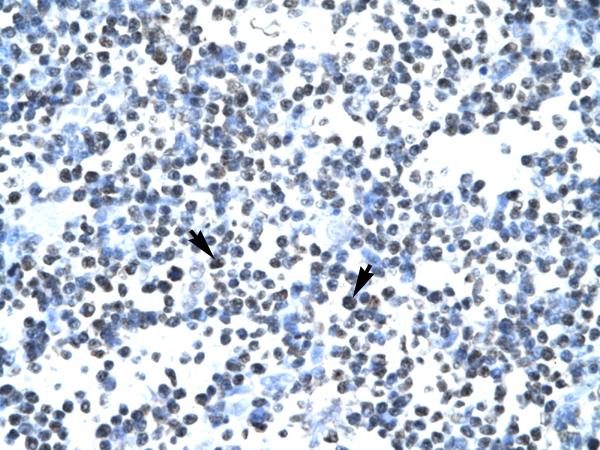ab22826 at 4.0 - 8.0 ug/ml, staining human DEK in paraffin embedded thymus tissue. Arrows indicate positively labelled cells (spleen cells).