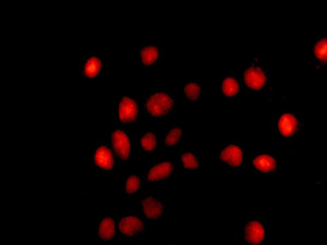 Immunofluorescence analysis of 293T cells labeling DEK with ab166624 at 1/100 dilution.