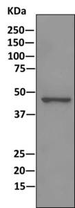 Immunoprecipitation of DEK in pellet from HeLa cell lysate using ab166624 at 1/10 dilution, followed by WB detection of DEK using as secondary an HRP-conjugated anti-rabbit IgG, which preferentially detects the non-reduced form of rabbit IgG.