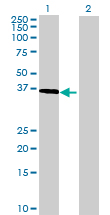 All lanes : Anti-Deleted in azoospermia 4 antibody (ab69157) at 1/500 dilutionLane 1 : Deleted in azoospermia 4 transfected 293T cell lysateLane 2 : Non-transfected 293T cell lysateLysates/proteins at 25 µg per lane.SecondaryGoat Anti-Mouse IgG (H&L)-HRP Conjugate at 1/2500 dilution