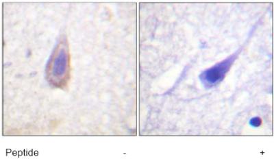 Ab63536 (1/50-1/100) staining human Delta Opioid Receptor in human brain tissue by immunohistochemistry using formalin fixed, paraffin embedded tissue. The left hand panel is without immunising peptide, whereas the right hand panel is in the presence of immunising peptide.