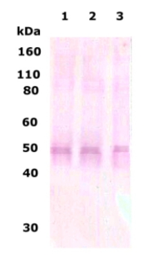 All lanes : Anti-Delta Opioid Receptor antibody (ab66318) at 1/500 dilutionLane 1 : human brain lysate at 10 µgLane 2 : rat brain lysate at 10 µgLane 3 : mouse brain lysate at 10 µg
