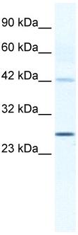 Anti-Connexin 30.3 / GJB4 antibody (ab32598) at 1.25 µg/ml + Jurkat cell lysate at 1 mg/mlSecondaryHRP conjugated anti Rabbit IgG at 1/50000 dilution