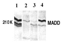 All lanes : Anti-DENN antibody (ab2043) at 1/250 dilutionLane 1 : Hela whole cell lysateLane 2 : A431 whole cell lysateLane 3 : K562 whole cell lysateLane 4 : NIH3T3 whole cell lysate