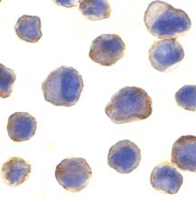ab2043 at 10µg/ml staining DENN in human spleen tissue by ICC
