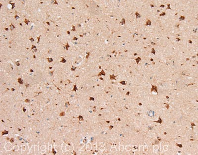 IHC image of DENND5A staining in human cerebral cortex formalin fixed paraffin embedded tissue section, performed on a Leica Bond system using the standard protocol F. The section was pre-treated using heat mediated antigen retrieval with sodium citrate buffer (pH6, epitope retrieval solution 1) for 20 mins. The section was then incubated with ab107678, 1µg/ml, for 15 mins at room temperature and detected using an HRP conjugated compact polymer system. DAB was used as the chromogen. The section was then counterstained with haematoxylin and mounted with DPX.For other IHC staining systems (automated and non-automated) customers should optimize variable parameters such as antigen retrieval conditions, primary antibody concentration and antibody incubation times.