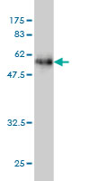 Western blot against tagged recombinant protein immunogen using ab54750 Deoxyribonuclease I like 1 antibody at 1ug/ml. 