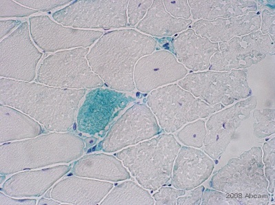 ab52138 (1/300) detecting Dermcidin in frozen skeletal muscle tissue sections (mouse). Tissues were fixed with paraformaldehyde and blocked in 5% BSA. For further experimental details please refer to abreview.See Abreview