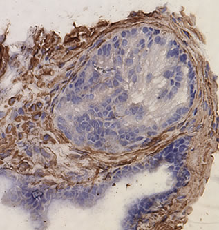 ab8592 was used to stain mouse prostate.