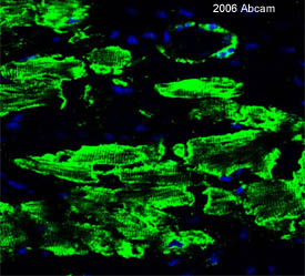 ab8592 staining infarcted rat tissue sections by IHC-P. Myocardial infarction was produced in a rat model following ligation of left anterior descending coronary artery. The tissue was harvested 4 weeks after this, fixed with Histochoice for 72 hr, paraffin sectioned and the slide was then baked. ab8592 was incubated overnight at 4°C and an Alexa-Fluor ® 488 donkey anti-rabbit antibody was used as the secondary. The image shows desmin expressing (green) native cardic myocytes and vascular smooth muscle cells at the infarct border zone of the heart tissue counterstained nuclei (DAPI-blue). Note the desmin filaments are localized predominantly in the Z-bands in the cardiac muscle cells. In the smooth muscle cells, desmin has a cytoplasmic localization (associated with cytoplasmic dense bodies and subplasmalemmal dense plaques).See Abreview
