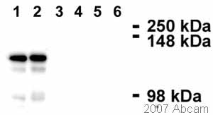 All lanes : Anti-Desmoglein 2 antibody [3G132] (ab14415) at 3 µg/mlLane 1 : U2OS (Hu) whole cell lysateLane 2 : 293T (Hu) whole cell lysateLane 3 : Cos-7 (AGMk) whole cell lysateLane 4 : CHO (Hm) whole cell lysateLane 5 : PC12 (Rat) whole cell lysateLane 6 : 3T3 (Ms) whole cell lysateLysates/proteins at 30 µg per lane.SecondaryHRP conjugated goat anti-mouse antibodydeveloped using the ECL techniquePerformed under reducing conditions.