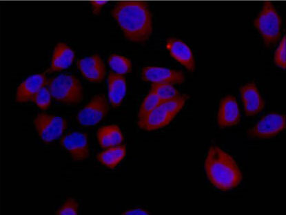 Immunofluorescent analysis of 4% paraformaldehyde-fixed HeLa cells labeling Destrin with ab186754 at 1/500 dilution followed by Goat anti rabbit IgG (Alexa Fluor® 555) secondary antibody at 1/200 dilution. Counter stained with Dapi (blue).