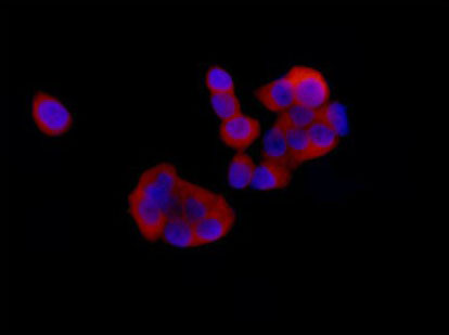 Immunofluorescent analysis of 4% paraformaldehyde-fixed MCF-7 cells labeling Destrin with ab186754 at 1/1000 dilution followed by Goat anti rabbit IgG (Alexa Fluor® 555) secondary antibody at 1/200 dilution. Counter stained with Dapi (blue).