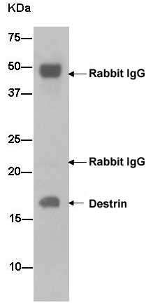Western blot analysis of Destrin in A549 cell lysate immunoprecipitated with ab186754 at 1/50 dilution. Secondary antibody: Goat Anti-Rabbit IgG, (H+L), Peroxidase conjugate at 1/1000 dilution.