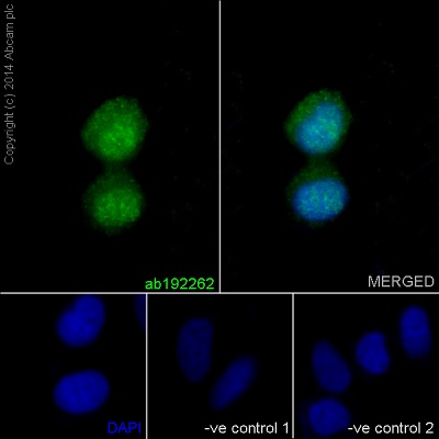 Immunofluorescent analysis of 4% formaldehyde fixed MCF-7 cells labeling Destrin using ab192262 at a 1/50 dilution. A Goat anti rabbit IgG (Alexa Fluor®488) ab150077 was used as the secondary at a 1/200 dilution. Permeabilized using 0.1% Triton X-100. The two negative controls; 1. Primary ab concentration (anti-Destrin ) is 1:50 dilution, Secondary ab (Goat anti mouse IgG (Alexa Fluor®594)) is 1:500 dilution; 2. Primary ab concentration (anti-Destrin ) is 1:50 dilution, Secondary ab (Goat anti mouse IgG (Alexa Fluor®594)) is 1:500 dilution.