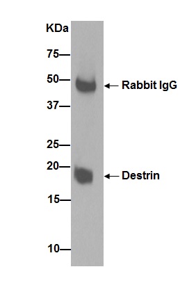 Lysate from A549 cells was immunoprecipitated with ab192262 at a 1/30 dilution. For the subsequent blot, ab192262 used at a 1/1000 dilution with Goat Anti-Rabbit IgG, (H+L), Peroxidase conjugated at a 1/1000 dilution for the secondary. Blocking/ Dilution buffer: 5% NFDM/TBST.
