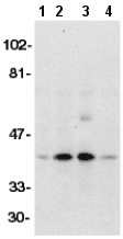 All lanes : Anti-DFFB antibody (ab8406) at 1/500 dilutionLane 1 : HeLa whole cell lysateLane 2 : K562 whole cell lysateLane 3 : Jurkat whole cell lysateLane 4 : Raji whole cell lysate