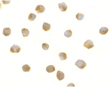 ab8406 at 5µg/ml staining DFFB in Jurkat cells by ICC/IF