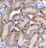 ab8401 at 2µg/ml staining DFFB in mouse kidney tissue by IHC
