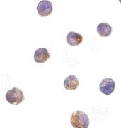 ab8407 at 10µg/ml staining DFFB in K562 by ICC/IF