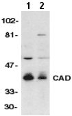All lanes : Anti-DFFB antibody (ab8400) at 1/500 dilutionLane 1 : Murine lung tissue lysateLane 2 : Murine kidney tissue lysate