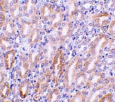 ab8400 at 1µg/ml staining CAD in mouse kidney tissue by IHC