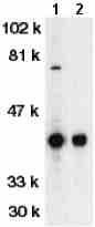 All lanes : Anti-DFFB antibody (ab8408) at 1/500 dilutionLane 1 : Jurkat whole cell lysateLane 2 : K562 whole cell lysateObserved band size : 40 kDa (why is the actual band size different from the predicted?)